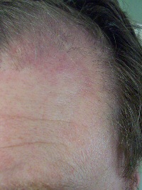 just a little discoloration!